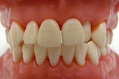 のて歯科クリニック歯周病初期症状